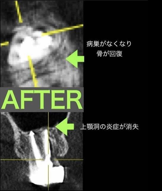 治療後写真