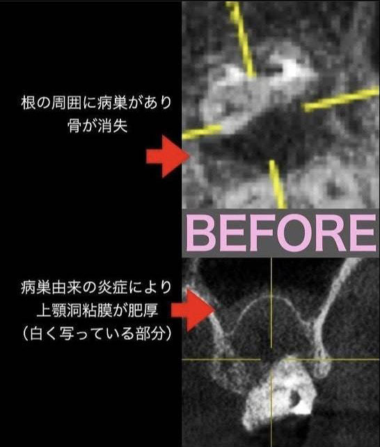 治療前写真